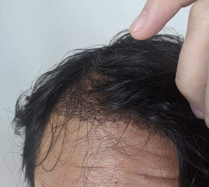 2 days later hair